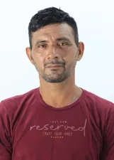 DOUVAS NUNES FIGUEIREDO