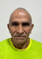 JOVERCINO CANDIDO DE ALMEIDA