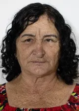 DORVINA BARBOSA DA COSTA DE ALMEIDA