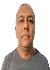 JORIEDSON DE LIMA MONTEIRO