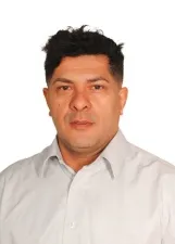 CARLOS ALBERTO TELES DE LIMA