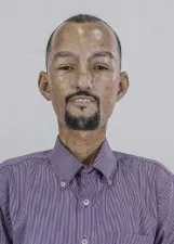 SAMÁRIO DE OLIVEIRA GOMES