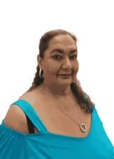 TERESA ALVES