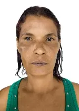 ANA KEILA DE ALMEIDA SILVA