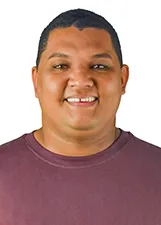HERCULES DOS SANTOS DE ALMEIDA