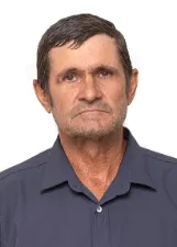 ALBERTODIO FERREIRA DOS SANTOS