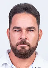 UANDERSON  SOARES SANTOS