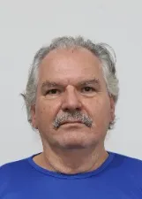 MADSON ALVES DA SILVA FURTADO