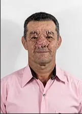 RUI LEITE DA SILVA