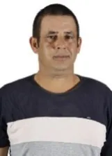 WELITON DE CARVALHO