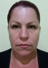 ERIKA FERNANDES