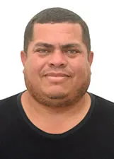 ANDERSON ALBUQUERQUE DOS SANTOS
