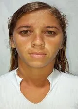 DENISE ANDRADE OLIVEIRA