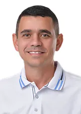 ALBERTO DUARTE DE SOUSA