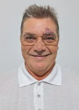 BERTOLDO CARDOSO MINATTI