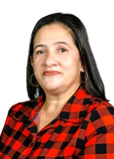 JANETE ALBANO DOS SANTOS