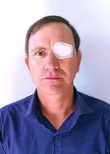 REINALDO FRANCO GONCALVES