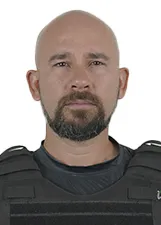 EDERSON ANDRADE DE ALBUQUERQUE