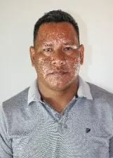 LEOMAR WAINNE XERENTE